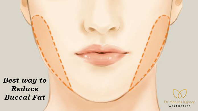 How to reduce face fat | Dr Monisha Kapoor